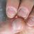 How to wean a child from biting his nails: the cause of the disorder, folk recipes and recommendations from psychologists How to wean himself from biting his nails